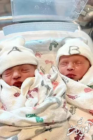 مورد جالب دوقلوهایی که در روز، ماه و سال متفاوتی به دنیا آمده اند